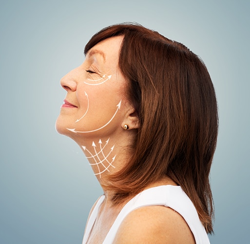 profile of senior woman with face lifting arrows facelift